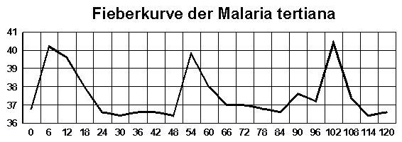 Fieberkurve der Malaria tertiana